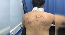 In pictures: The torture marks left on kidnapped Younis Qandil