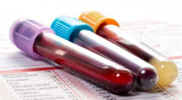 200-people-test-negative-for-covid-19-in-jerash-roya-news