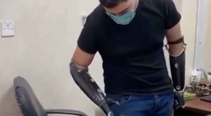 VIDEO: Zarqa crime victim shares video using prosthetic arms