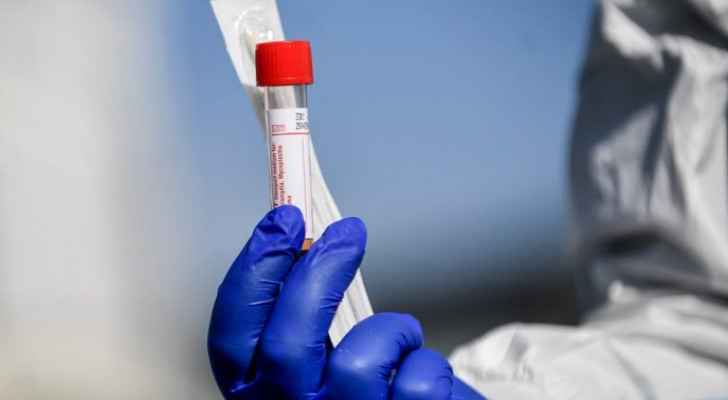 Jordan records 19 deaths and 2,170 new coronavirus cases