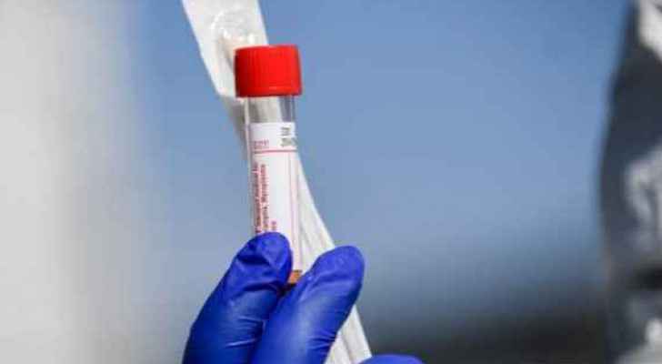 PCR test accuracy reaches 80%: Hijjawi