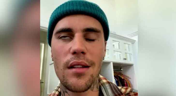 Justin Bieber announces he has facial paralysis due to Ramsay Hunt syndrome