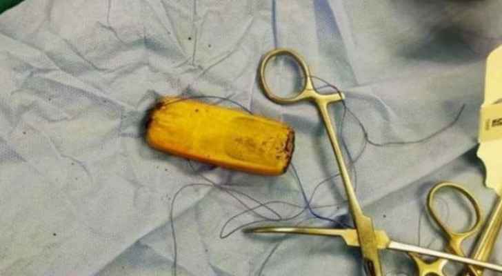 Mobile phone extracted from inmate's stomach in Egypt