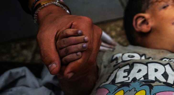 A man holding the hand of a Palestinian boy targeted in “Israeli” bombardment. (May 27, 2024) (Photo: AFP)  